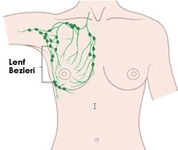 Koltuk Altı Lenf Bezi Büyümesi Belirtileri ve Tedavisi Koltuk Altı Lenf Bezi Büyümesi Belirtileri ve Tedavisi