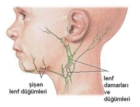 Lenf Bezlerinin Görevi Nedir? Lenf Bezlerinin Görevi Nedir?