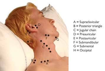 Boyunda Lenf Nodu Boyunda Lenf Nodu