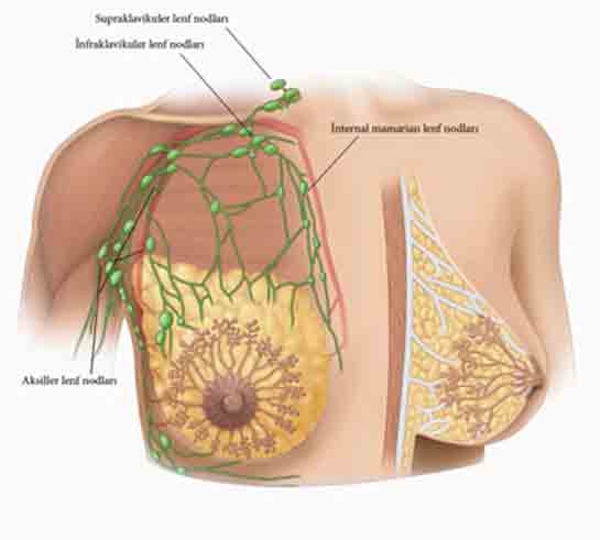 Göğüste Lenf Nodu