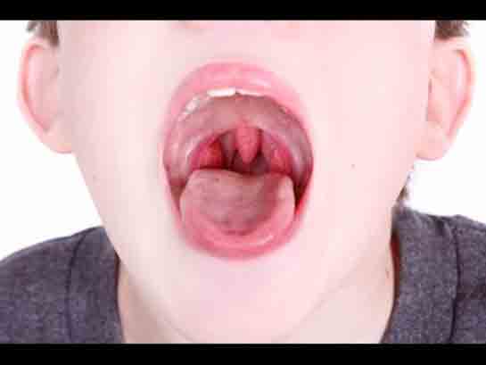 Sol Lenf Bezi Şişmesi Belirtileri ve Tedavisi